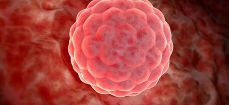 Mumbai, Health, Advance Blastocyst Treatment In Bhagalpur At Urmila Hospital