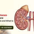 Main Causes Of Kidney Stones Explained