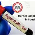 Herpes Simplex Treatment In South Africa