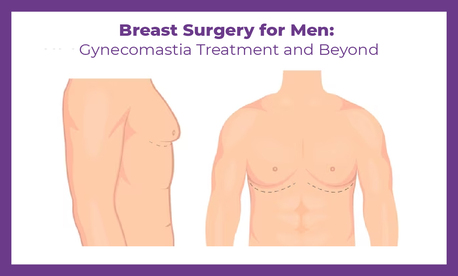 Mumbai, Health, Gynecomastia Surgery Procedure Cost And Recovery