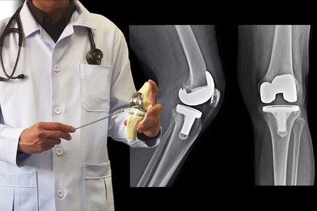 Mumbai, Health, Dr. Anant Kumar Tiwari- Orthopaedic Surgeon Delhi