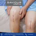 Leading Partial Knee Replacement Surgery &ndash; Saviour Hospital