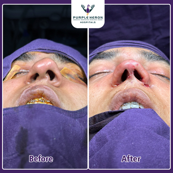 Jaipur, Health, Best Plastic Surgeon In Jaipur