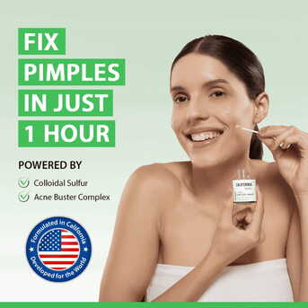 New York, Fashion & Design, Pimple Emergency? Handle It Fast