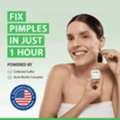 Pimple Emergency? Handle It Fast