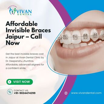 Jaipur, Business, Affordable Invisible Braces Jaipur &ndash; Call Now