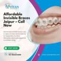 Affordable Invisible Braces Jaipur &ndash; Call Now
