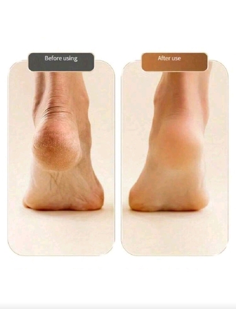 Riyadh, Health & Beauty Items, SAR 30,  Electric Foot Exfoliator, Portable Rechargeable Callus Remover, 2 Grinding Rotating Heads