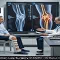Advanced Broken Leg Surgery For Faster Recover