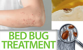 Dubai, Cleaning, Bed Bugs Pest Control Dubai | Fast & Guaranteed Relief | +971 56 695 2225