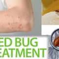 Bed Bugs Pest Control Dubai | Fast & Guaranteed Relief | +971 56 695 2225