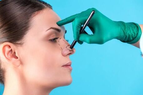 Mumbai, Health, Book Rhinoplasty Surgery In Mumbai At Hair And Shape Clinic
