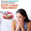 Root Canal Treatment In Hyderabad