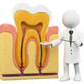 Best Root Canal Treatment In Delhi NCR
