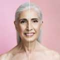 Anti-Aging Treatment Massachusetts Expert Skin Solutions