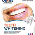 Ready For A Confident Smile With Teeth Whitening In Madhapur?
