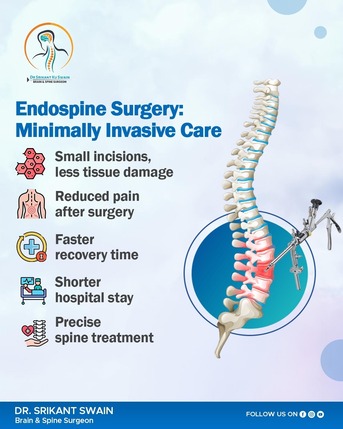 Mumbai, Health, Endospine Surgery | Best Neurosurgeon In Bhubaneswar | Dr. Srikant Swain