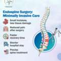 Endospine Surgery | Best Neurosurgeon In Bhubaneswar | Dr. Srikant Swain