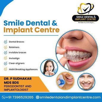 Hyderabad, Dental, Dental Clinic Near Me A.S. Rao Nagar Hyderabad