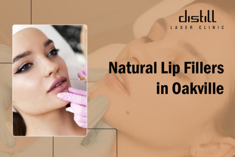 Toronto, Business, Lip Fillers Oakville | Natural, Plump & Beautiful Lips