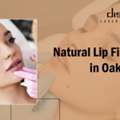 Lip Fillers Oakville | Natural, Plump & Beautiful Lips