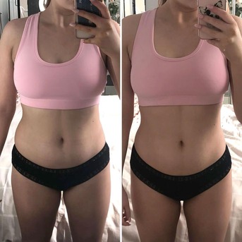 Sydney, Business, Fat Freezing Near Gold Coast &ndash; Miami Kiss International