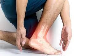 Singapore, Health, When To See A Doctor For A Suspected Ankle Ligament Tear