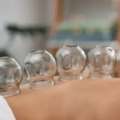 Professional Cupping Therapy Service In Bangalore For Natural Healing