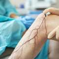 Trusted Vascular Surgeon In Gandhinagar