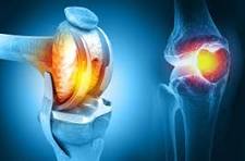 Hyderabad, Health, Which Hospital Provides You The Best Knee Replacement Surgery ?