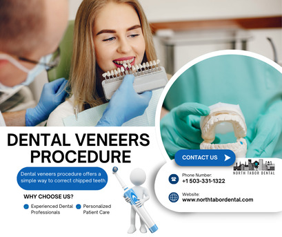 Washington DC, Health, Is Dental Veneers Procedure Painful ?