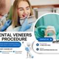 Is Dental Veneers Procedure Painful ?
