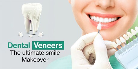 Washington DC, Health, Is Dental Veneers Procedure Painful ?