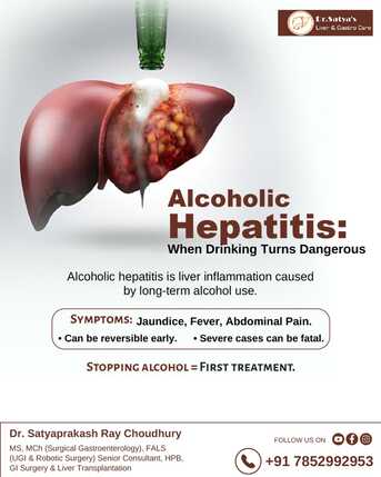 Mumbai, Health, Alcoholic Hepatitis | Dr. Satyaprakash Ray Choudhury, Bhubaneswar