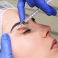 Botox Injections In Richmond Hill