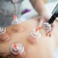Join Professional Cupping Therapy Course In Bengaluru Today