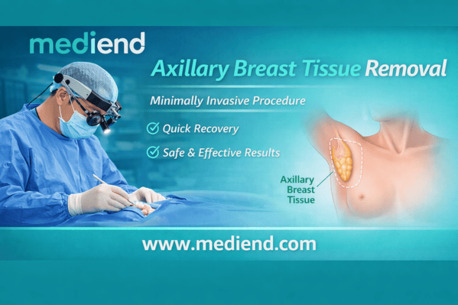 Mumbai, Health, Axillary Breast Tissue Removal Surgery