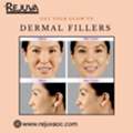 Dermal Fillers Newport Beach &ndash; Natural Volume & Youthful Contours