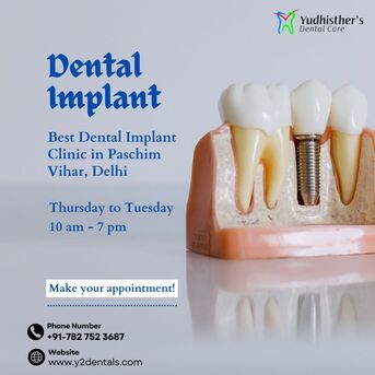 New Delhi, Dental, Most Trusted Dentist For Your Family - Paschim Vihar