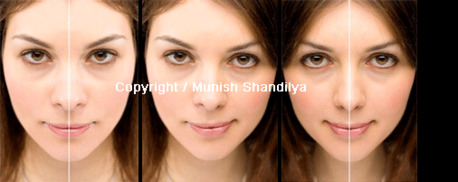 Dublin, Health, Rhinoplasty Ireland