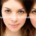 Rhinoplasty Ireland