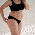 Transform Your Body With Liposuction In Cape Town