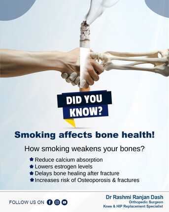 Mumbai, Health, Smoking Affects Bone Health | Dr Rashmi Ranjan Dash | Best Orthopaedic Specialist