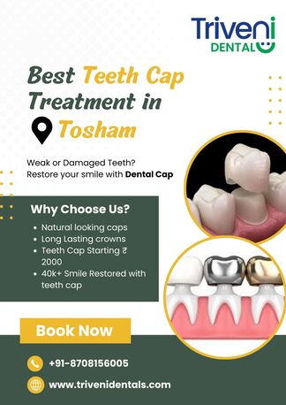 Haryana, Dental, Best Teeth Cap Treatment In Tosham | Triveni Dental
