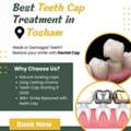 Best Teeth Cap Treatment In Tosham | Triveni Dental