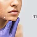 Get Thread Lift Treatment In Mumbai At Harleys Cosmetic Clinic