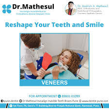 Mumbai, Dental, Best Dental Clinic In Pune Near Me | Dr Aashish Mathesul