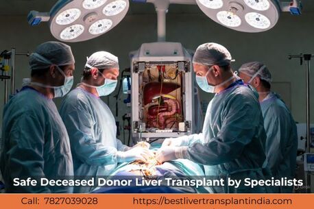 New Delhi, Medical, Advanced Care With Deceased Donor Liver Transplant India