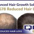 Advanced Hair Growth Solution &ndash; QR678 Reduced Hair Loss