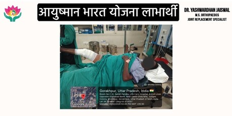 Mumbai, Health, Knee Replacement Specialist In Gorakhpur | Advanced Joint Care Hospital